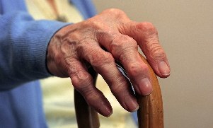 Artritis dan artrosis jari pada orang tua
