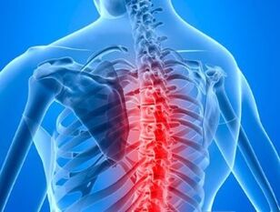Osteochondrosis pada tulang belakang dada