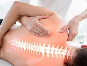 Terapi manual - metode pengobatan osteochondrosis