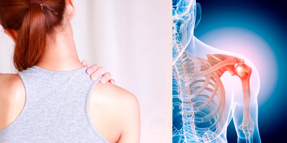 Perkembangan osteoartritis bahu secara bertahap menyebabkan rasa sakit yang konstan
