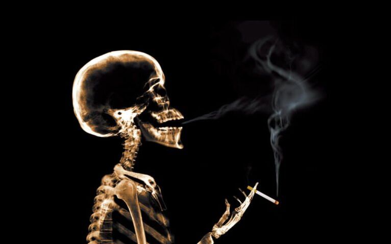 merokok sebagai penyebab sakit pinggang di area tulang belikat