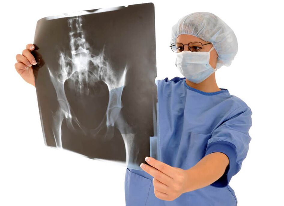 X-ray pada sendi panggul akan membantu dokter menentukan penyebab nyeri