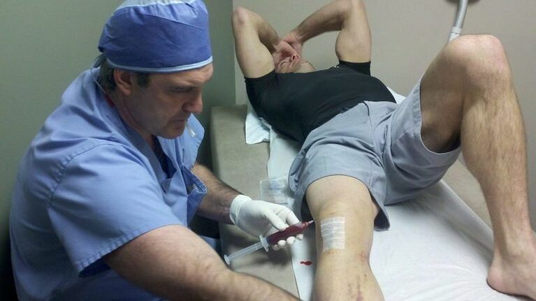 Pengobatan arthrosis sendi lutut