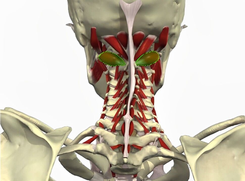 sindrom arteri vertebralis